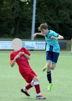 31.08.2025 SG Weixdorf II vs. Radeberger SV